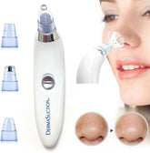 Aparat za uklanjanje mitisera