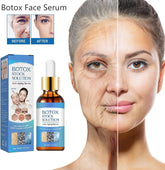 BOTOX serum za brzo podmlađivanje lica