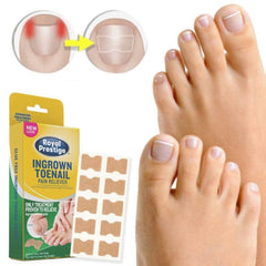 Flasteri za urasle nokte 1+1 GRATIS