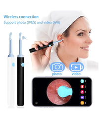 Otoskop kamera za pregled čišćenje uha - SA KAMEROM