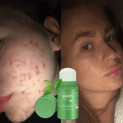 Green stick - Maska za lice 2+1 Gratis