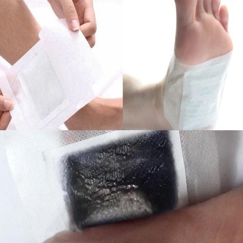 Kinoki detox flasteri 1+1 GRATIS (20kom)