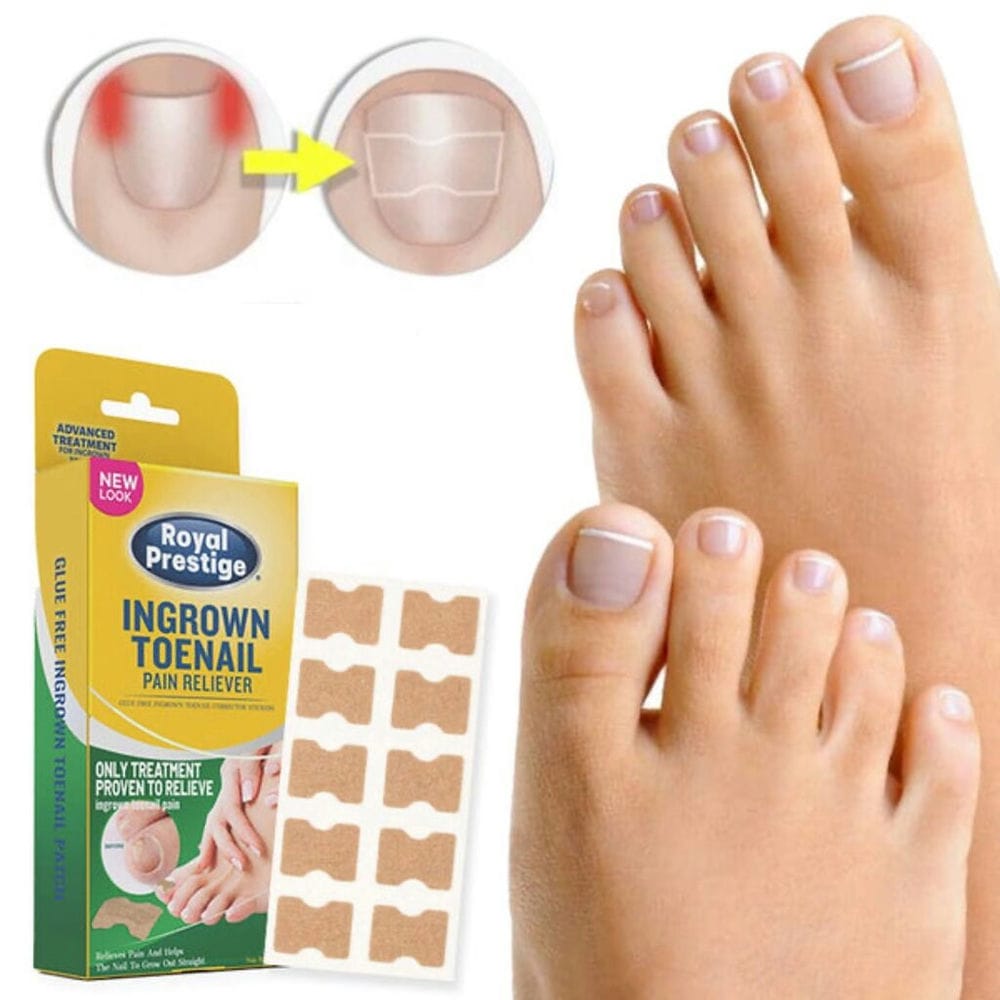 Flasteri za urasle nokte 1+1 GRATIS