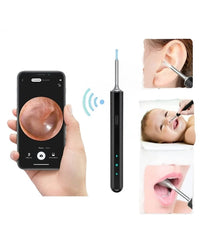 Otoskop kamera za pregled čišćenje uha - SA KAMEROM