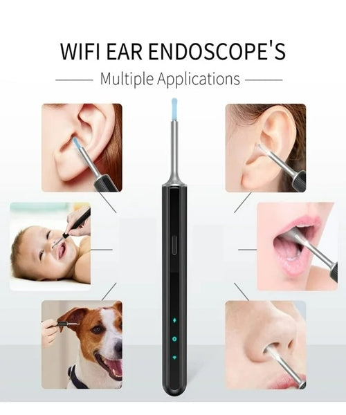 Otoskop kamera za pregled čišćenje uha - SA KAMEROM